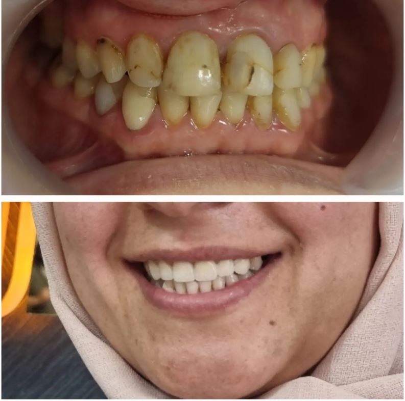 Ekran Alıntısı