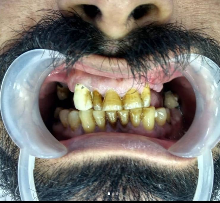 Ekran Alıntısı 5