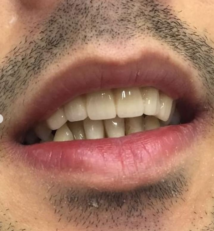Ekran Alıntısı 8